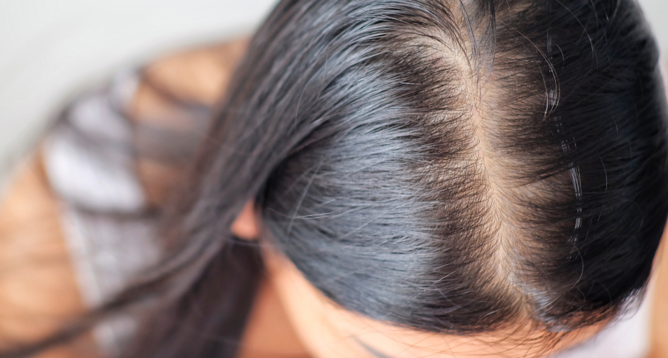 Hair Restoration for Women in Omaha, NE | Hair Center of NE