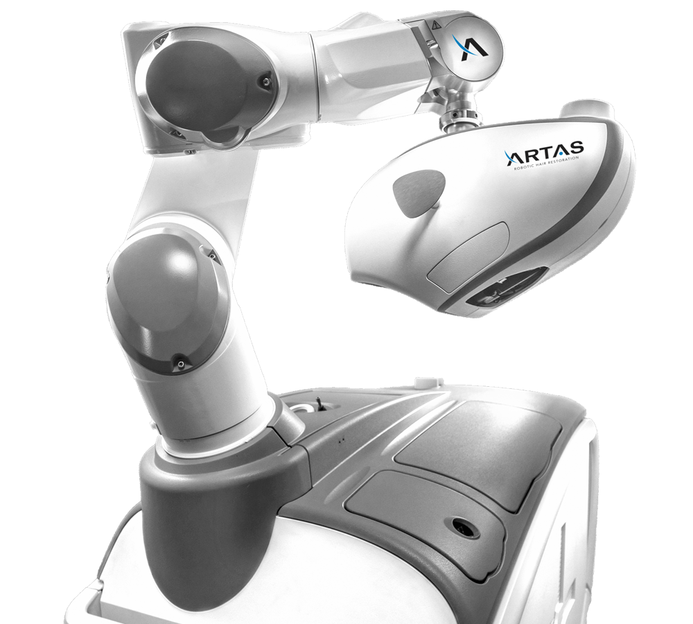 Robotic arm of the ARTAS system for hair restoration. This advanced technology aids in precision hair transplant procedures.