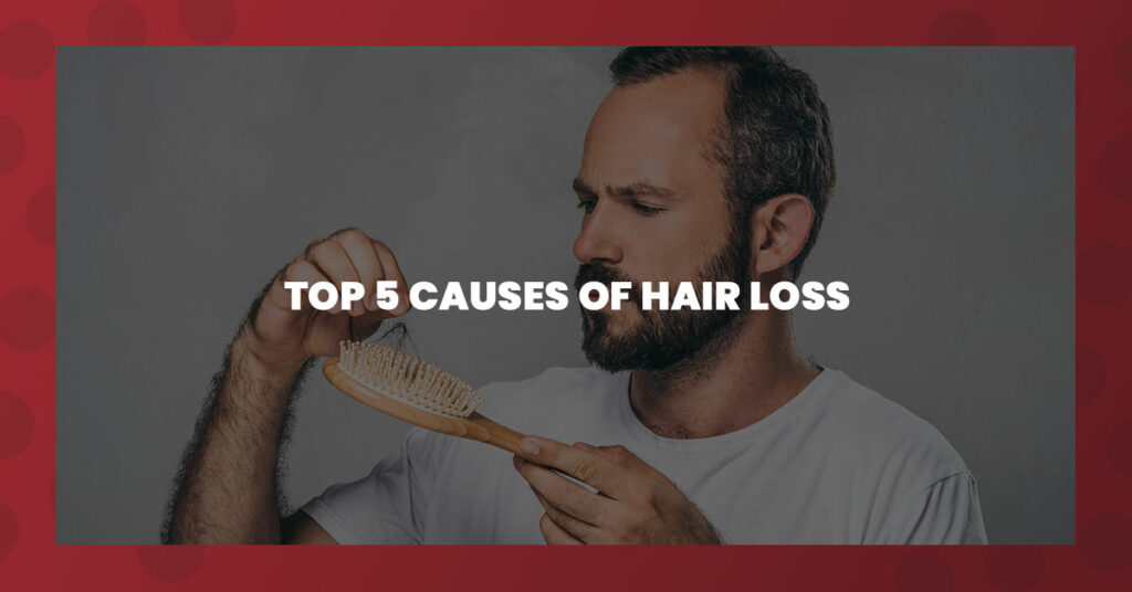 Man examining a hairbrush with strands of hair, highlighting the topic of hair loss. Text overlay: “Top 5 Causes of Hair Loss.”