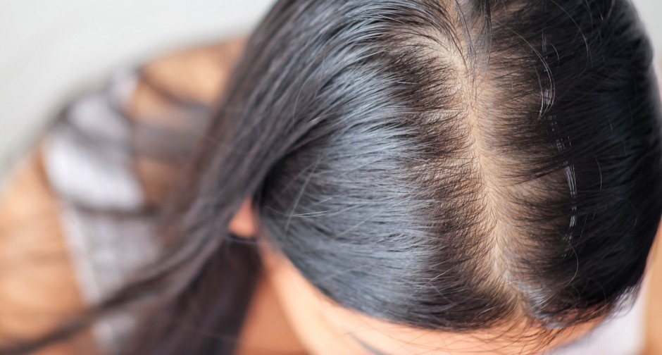Close-up view of a person's scalp showing healthy, straight black hair parted down the middle. Relevant for discussing hair care or styling tips.