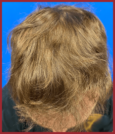 Close-up of tousled light brown hair against a blue background, illustrating a casual hairstyle. Relevant for discussions on hair styling or trends.