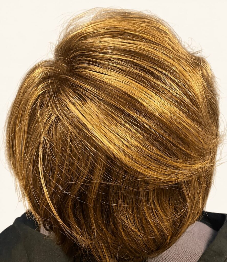 After hair restoration
