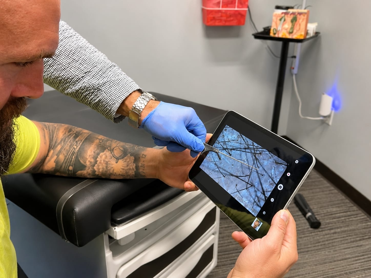 Magnified trichoscope view of scalp follicles on a tablet during a hair loss assessment